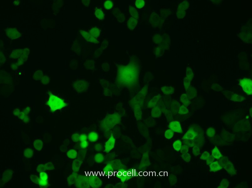 4T1-GFP（小鼠乳腺癌細(xì)胞（綠色熒光標(biāo)記））（STR鑒定正確）