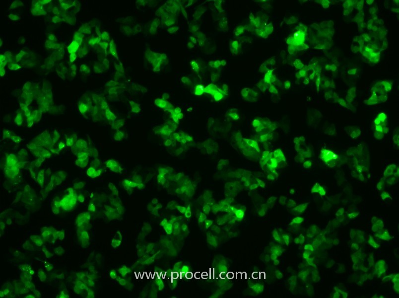Hep G2-GFP（人肝癌細(xì)胞（綠色熒光蛋白標(biāo)記））（STR鑒定正確）