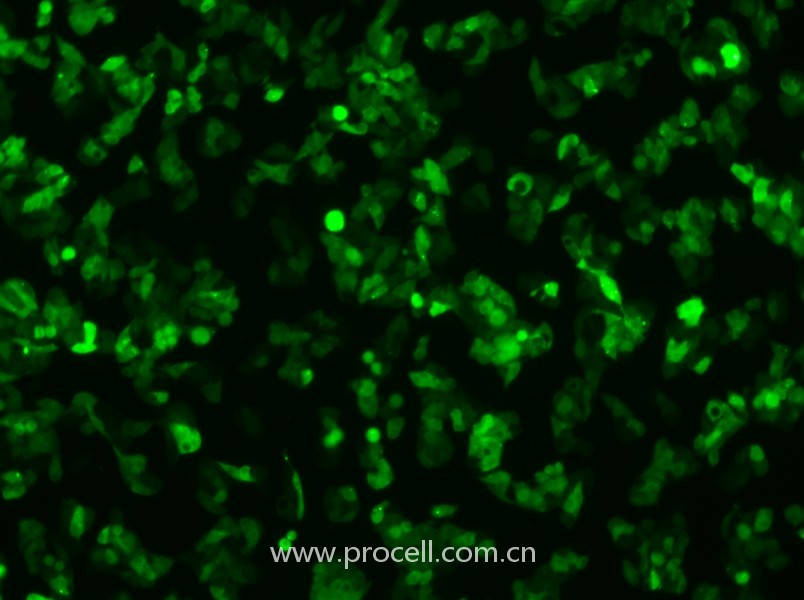Hep G2-GFP（人肝癌細(xì)胞（綠色熒光蛋白標(biāo)記））（STR鑒定正確）