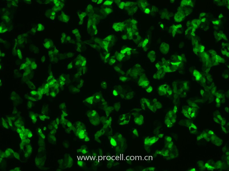Hep G2-GFP（人肝癌細(xì)胞（綠色熒光蛋白標(biāo)記））（STR鑒定正確）