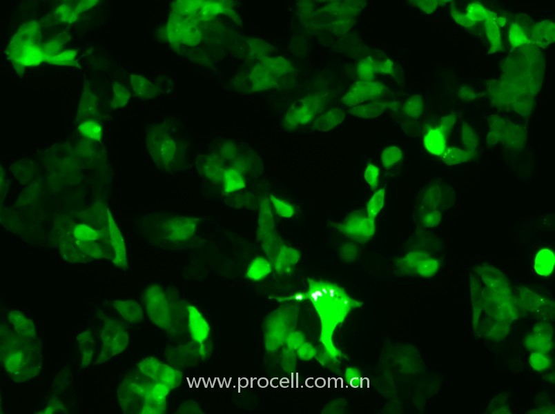 Hep G2-GFP（人肝癌細(xì)胞（綠色熒光蛋白標(biāo)記））（STR鑒定正確）