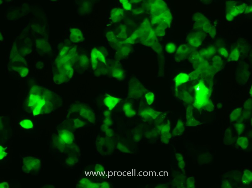 Hep G2-GFP（人肝癌細(xì)胞（綠色熒光蛋白標(biāo)記））（STR鑒定正確）