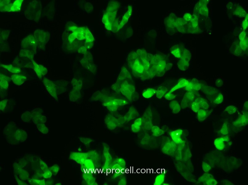 Hep G2-GFP（人肝癌細(xì)胞（綠色熒光蛋白標(biāo)記））（STR鑒定正確）