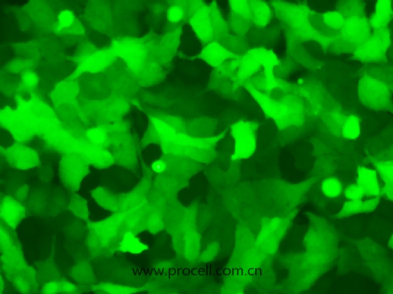 U-2 OS-LUC-EGFP（人骨肉瘤細(xì)胞（熒光素酶綠色熒光標(biāo)記））（STR鑒定正確）