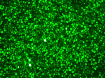 K-562-GFP（人慢性髓原白血病細(xì)胞（綠色熒光標(biāo)記））（STR鑒定正確）