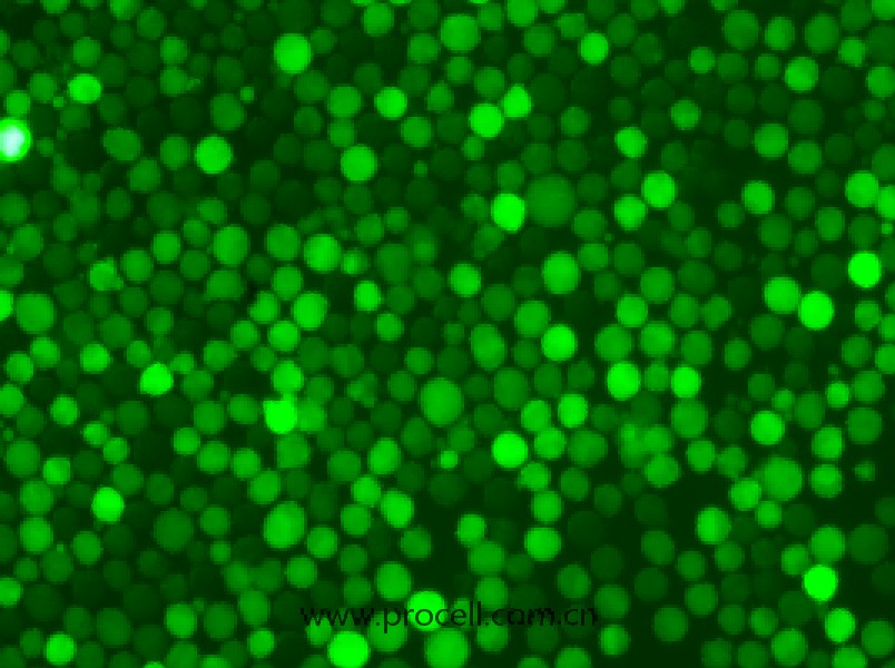 K-562-GFP（人慢性髓原白血病細(xì)胞（綠色熒光標(biāo)記））（STR鑒定正確）