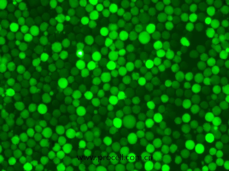 K-562-GFP（人慢性髓原白血病細(xì)胞（綠色熒光標(biāo)記））（STR鑒定正確）