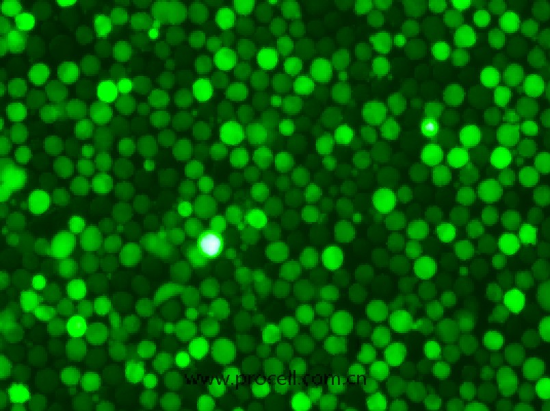 K-562-GFP（人慢性髓原白血病細(xì)胞（綠色熒光標(biāo)記））（STR鑒定正確）